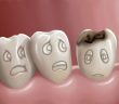 چگونه از پوسیدگی دندان جلوگیری کنیم؟